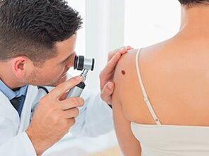 the doctor examines the papilloma about recommending removal with medication